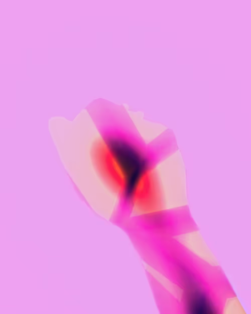 Item #4 Media