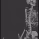 66