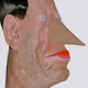 196