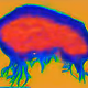 Hyphae
