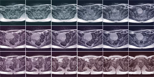 Item #33729904487083342964442328512687567246375750320202692497428806274679855644673 Media