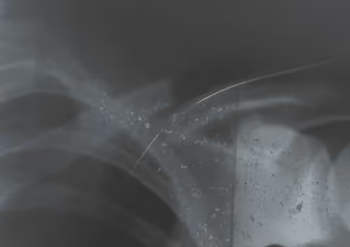 Item #42602188936332751126689195921772117794695800626097073962556397746040193679361 Media