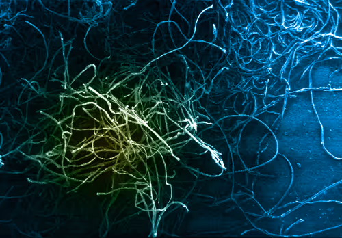 Item #115505927728344181025262329658899620468765138243295584093365708396800776339457 Media