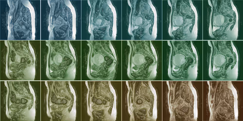 Item #33729904487083342964442328512687567246375750320202692497428806273580344016897 Media