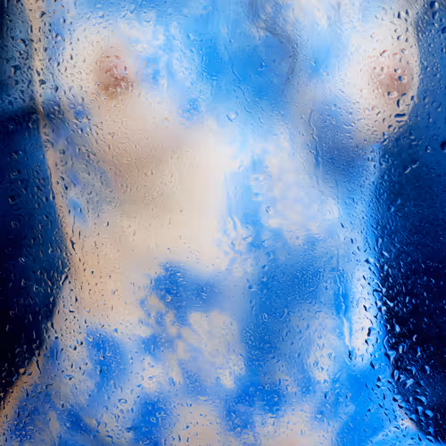 Birthmark