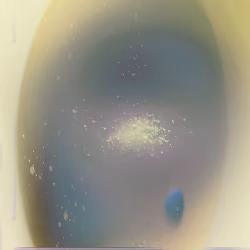 77