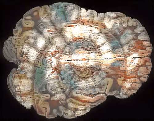 Item #29877578668728852178902598419785793077778618348046200683544678239283246530561 Media